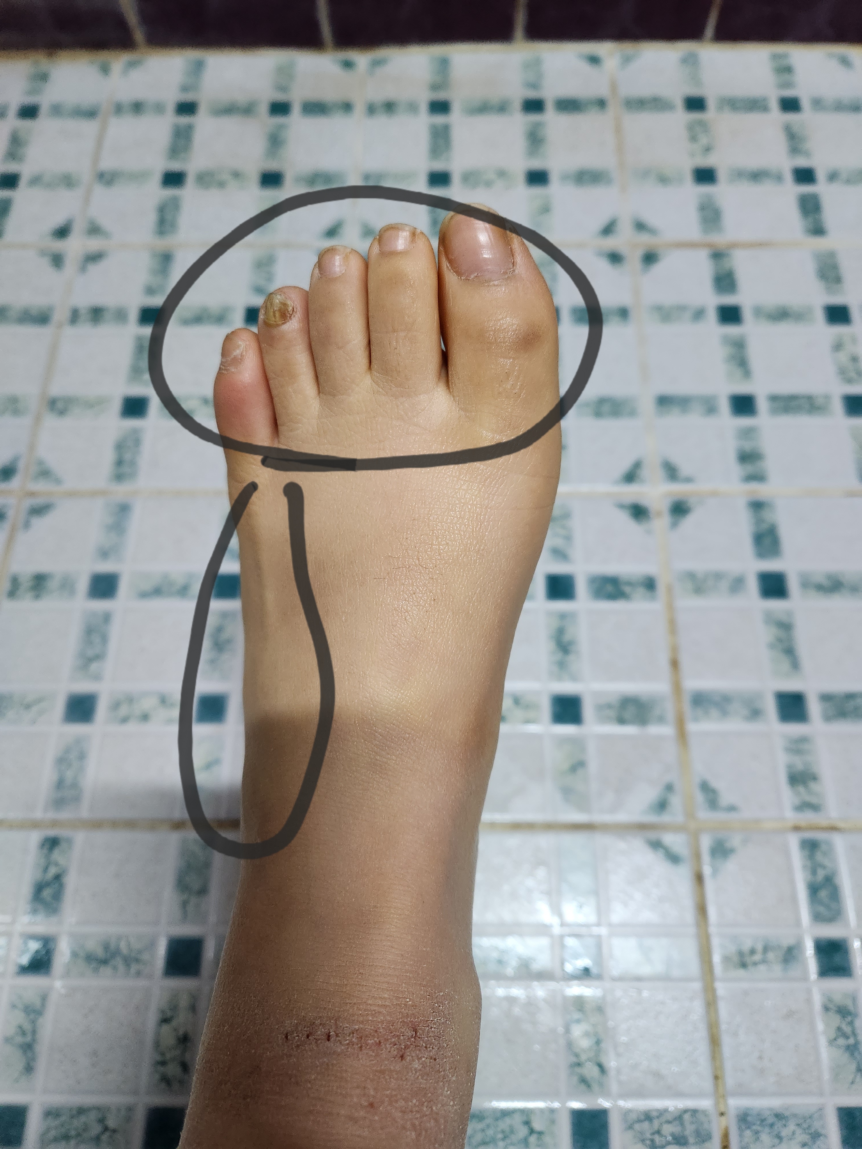 질문 이미지