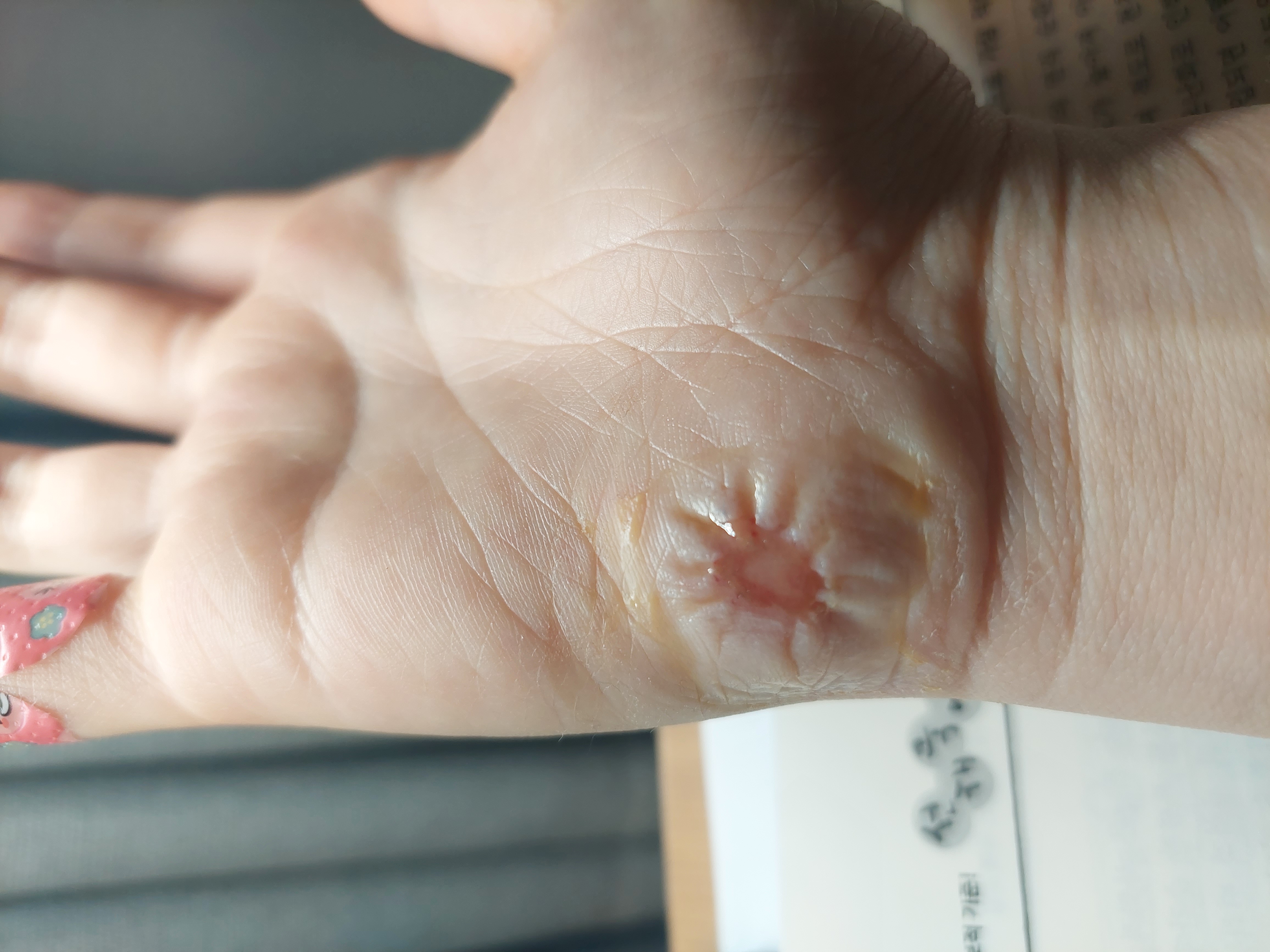 질문 이미지