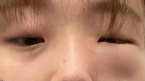 질문 이미지