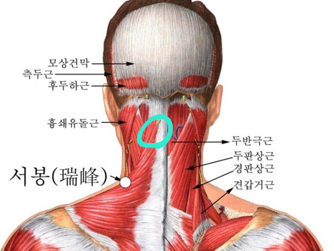 질문 이미지
