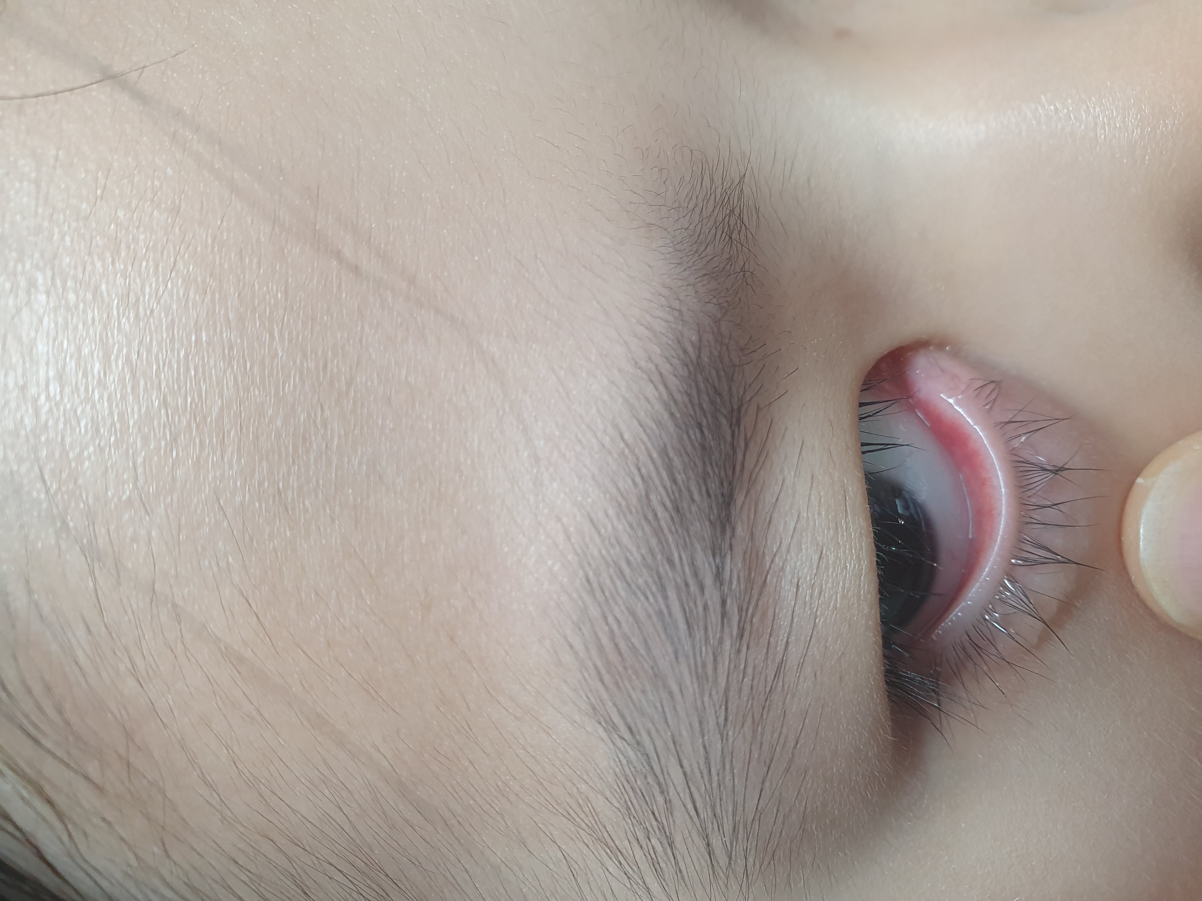 질문 이미지
