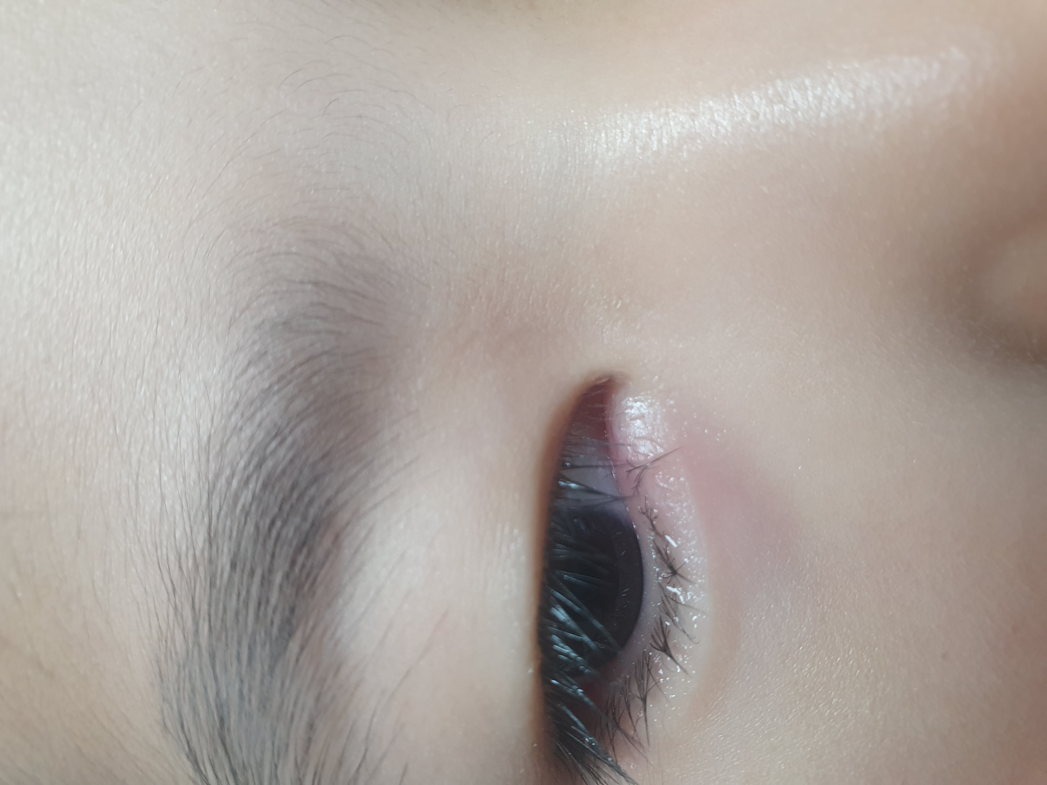 질문 이미지