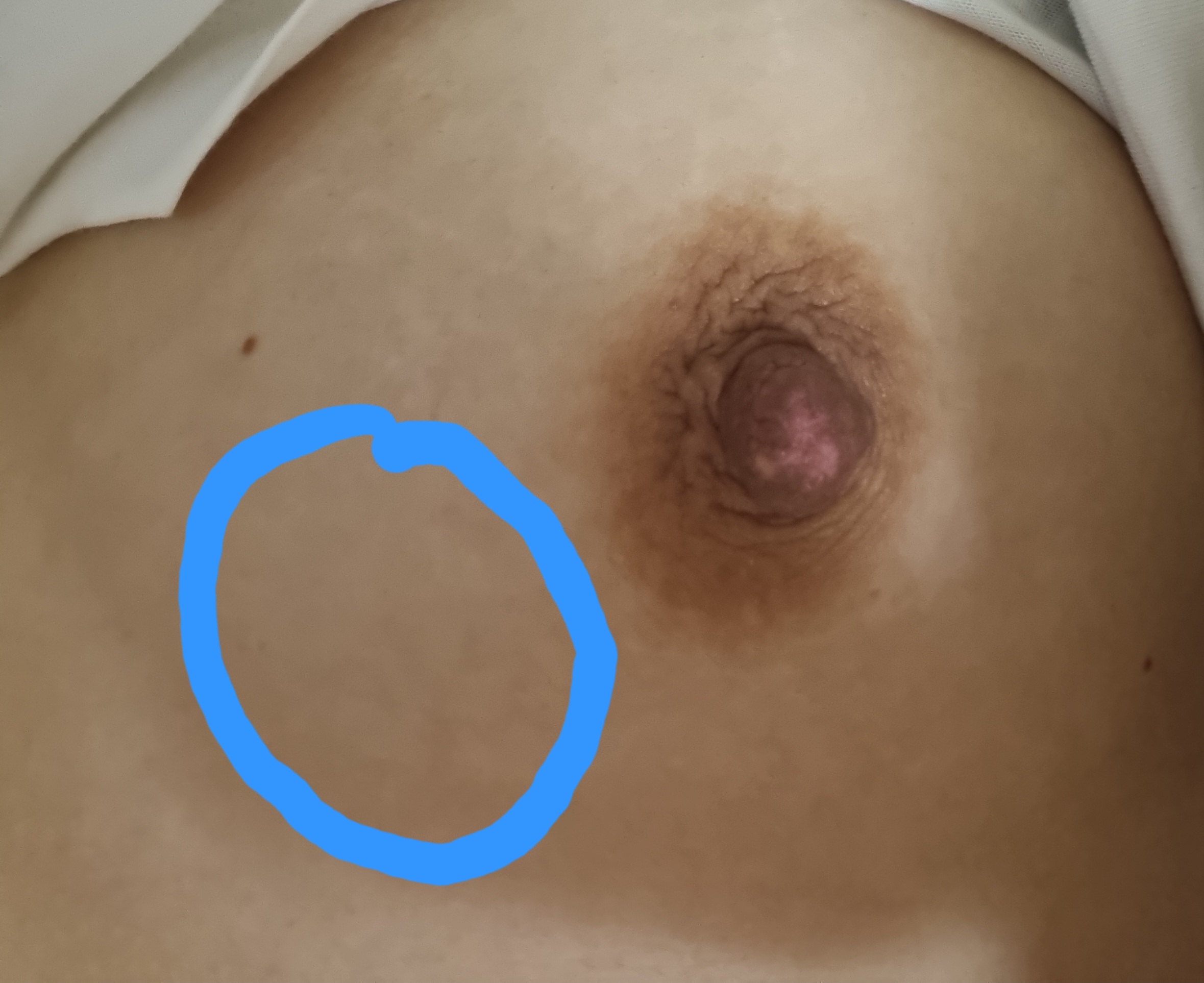질문 이미지