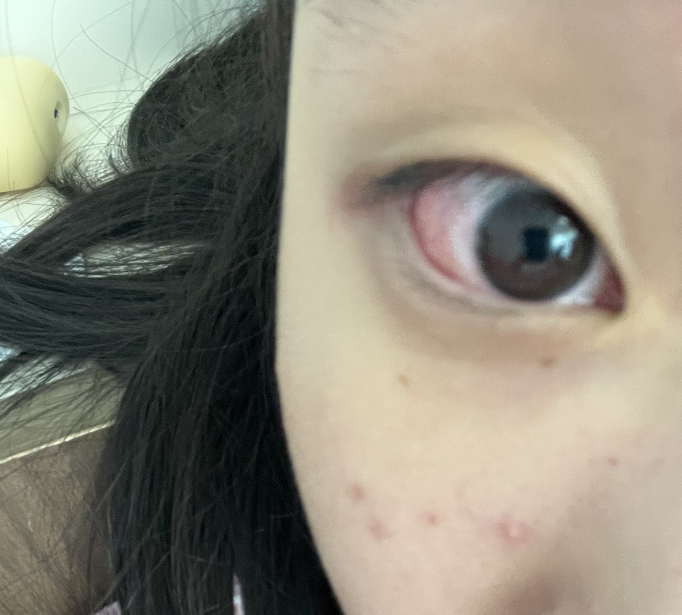 질문 이미지