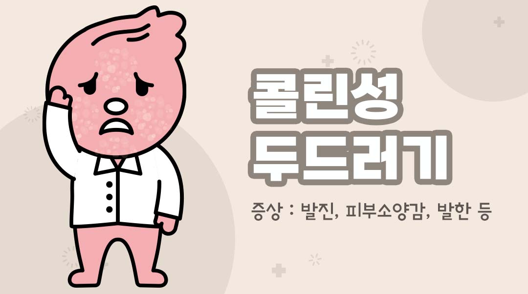 콜린성 두드러기이미지