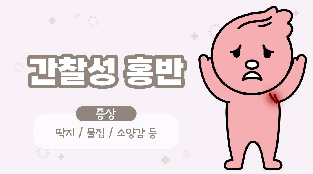 간찰성 홍반이미지