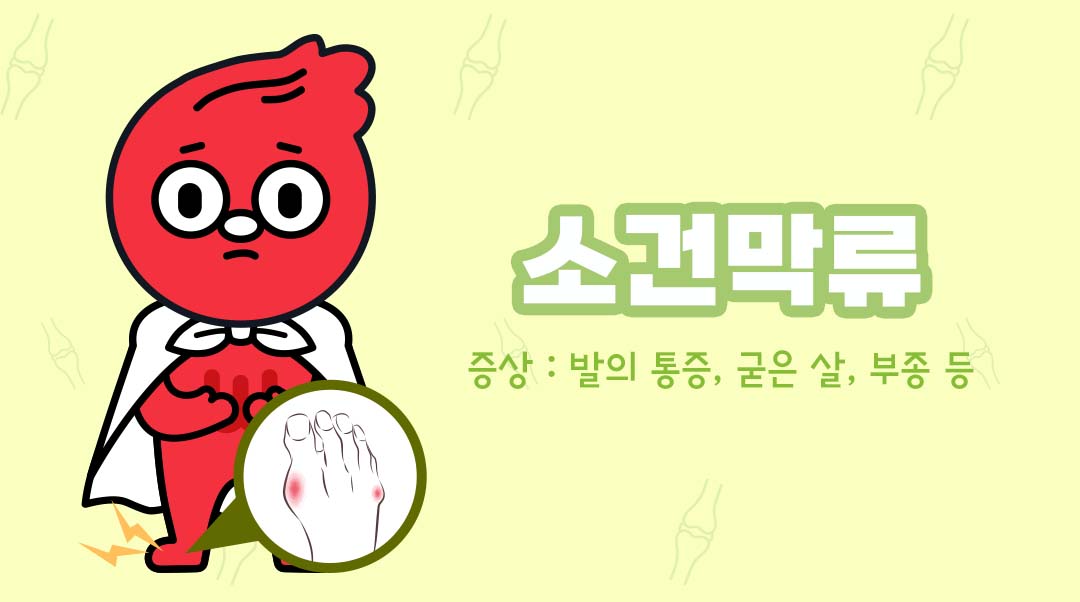 소건막류이미지