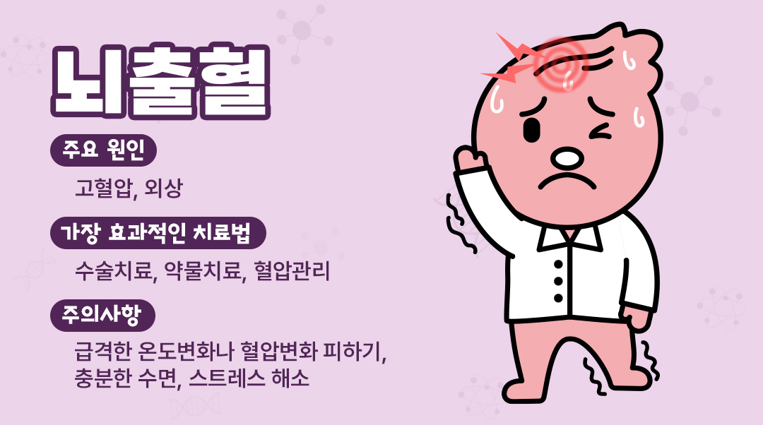 뇌출혈이미지