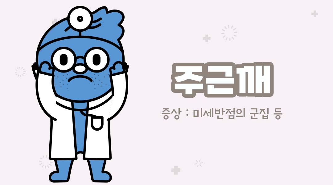 주근깨이미지