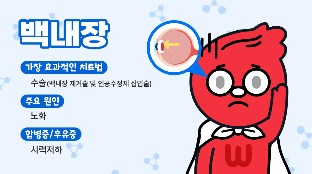 백내장이미지