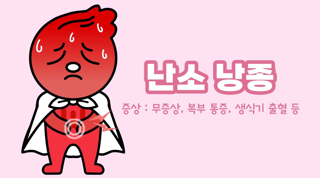난소 낭종이미지