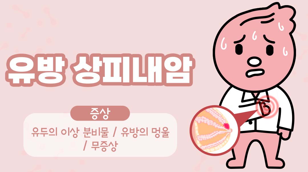 유방 상피내암이미지