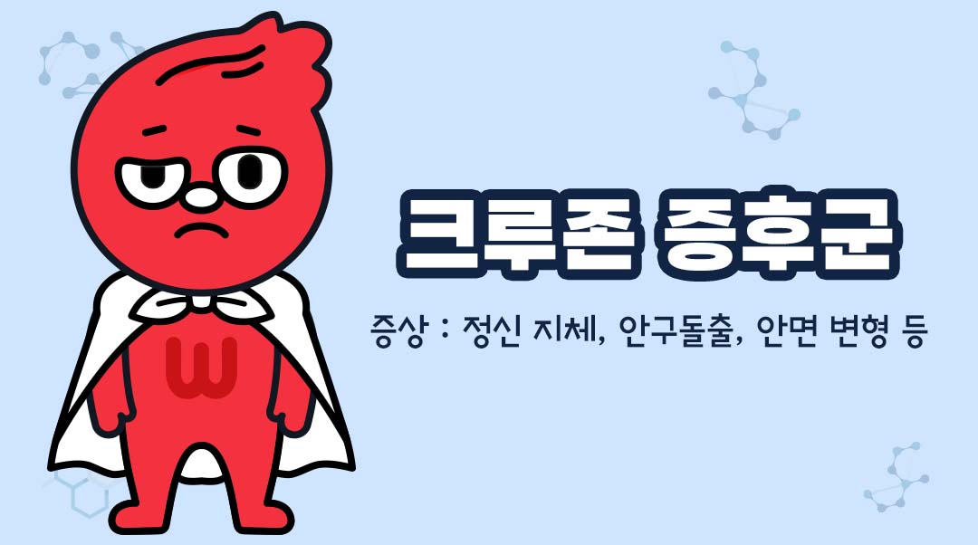 크루존 증후군이미지