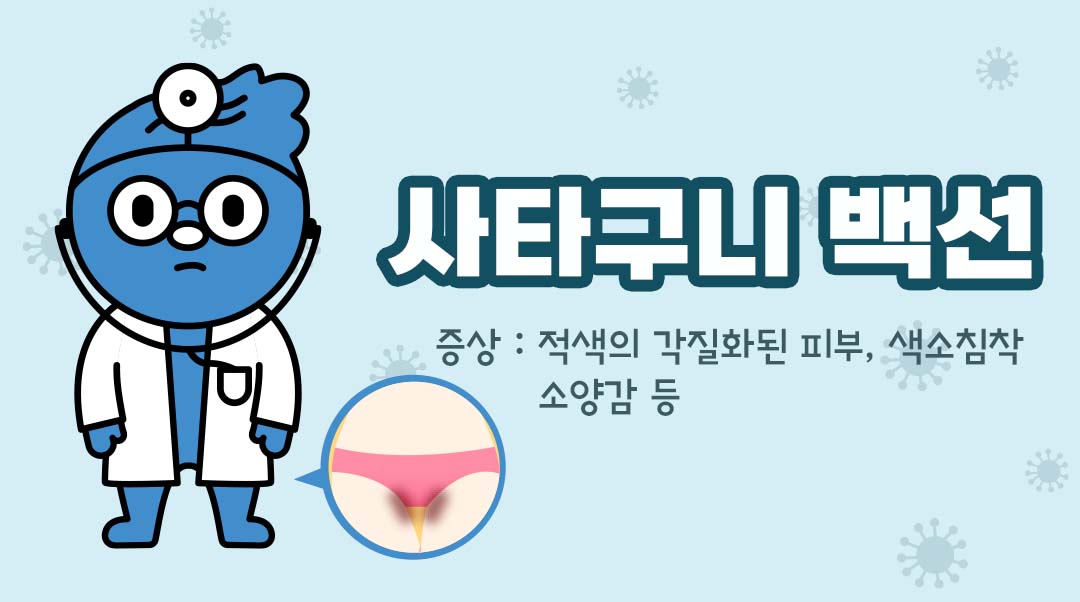 사타구니 백선이미지