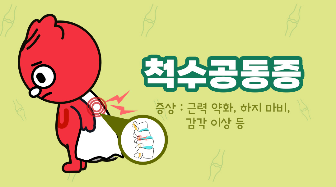 척수공동증이미지