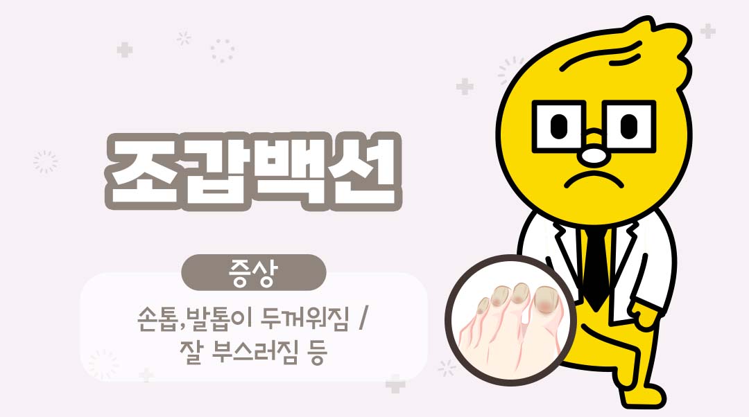 조갑백선이미지