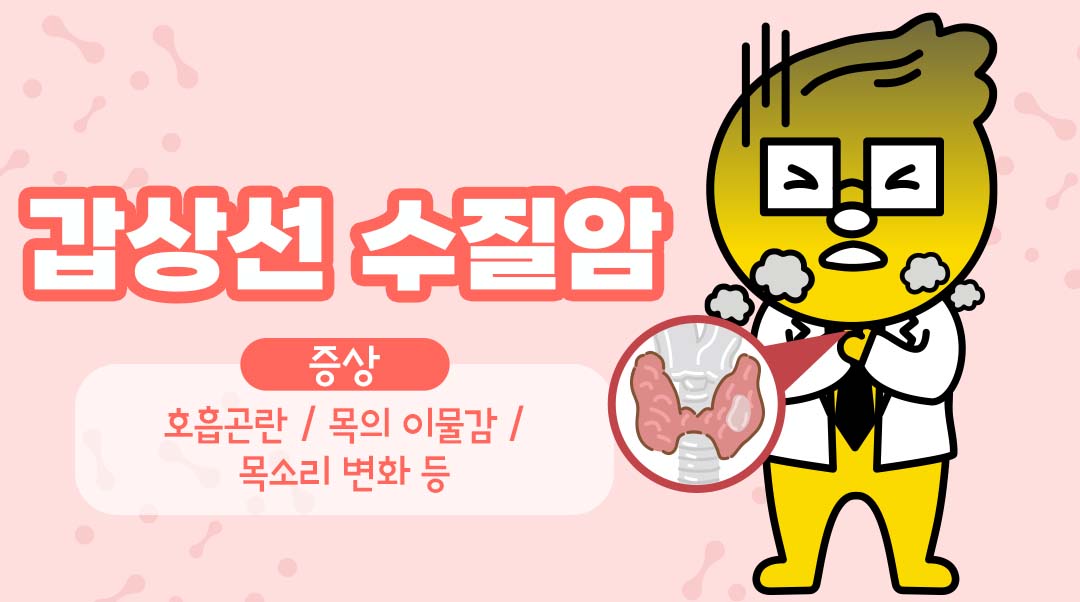 갑상선 수질암이미지