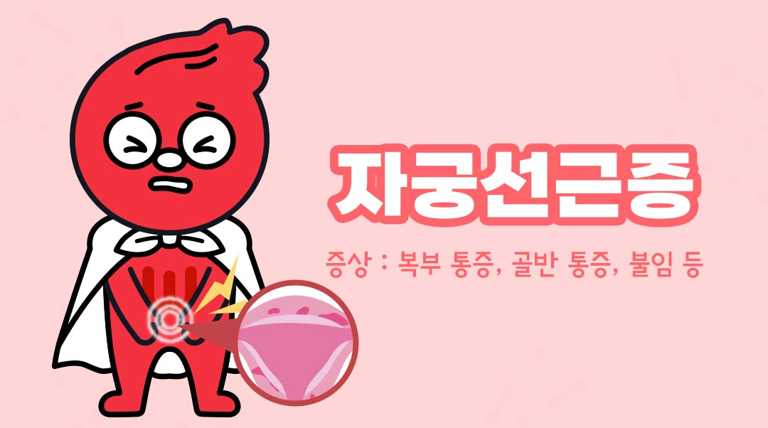 자궁선근증이미지