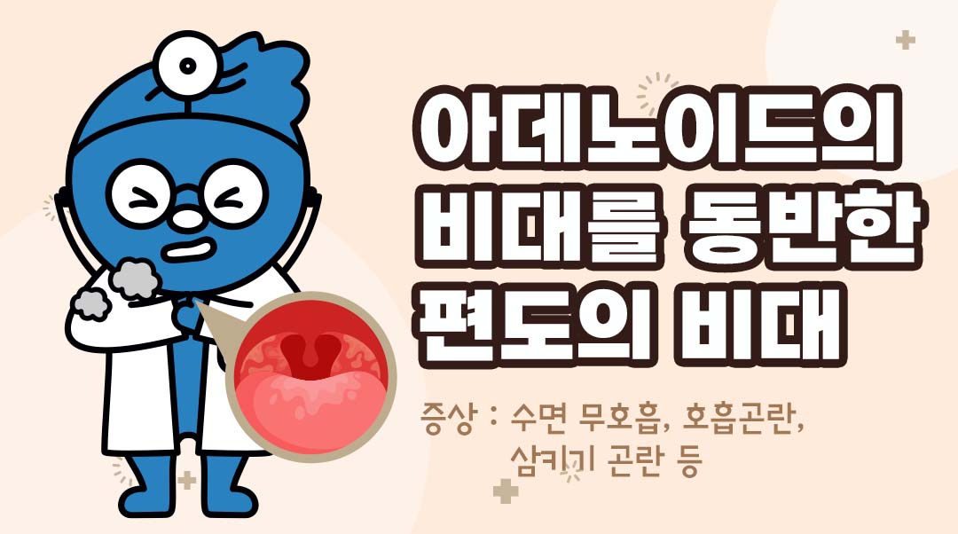 아데노이드의 비대를 동반한 편도의 비대이미지