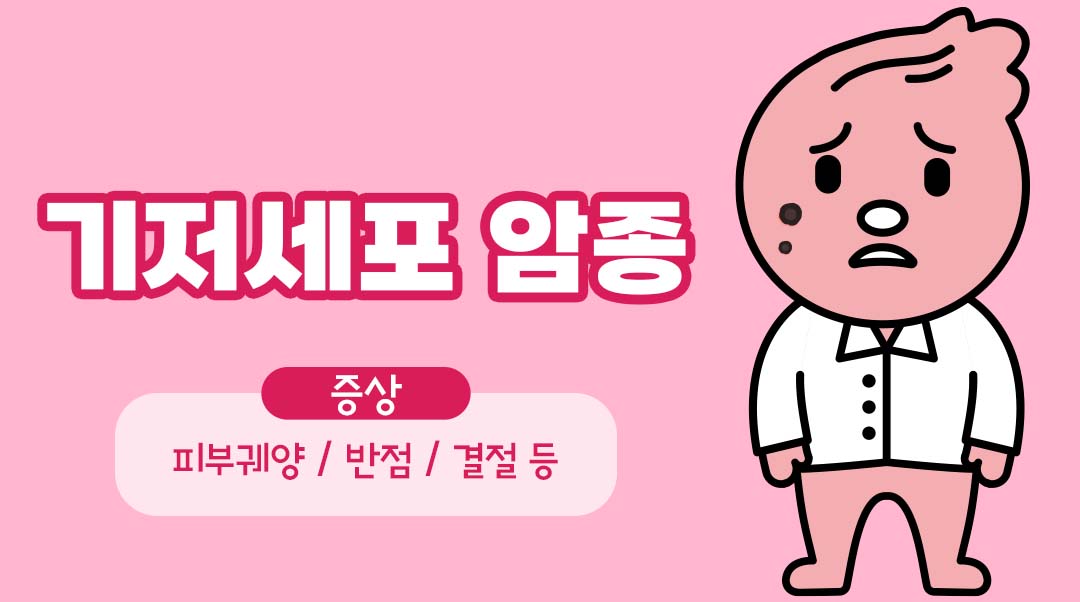 기저세포 암종이미지