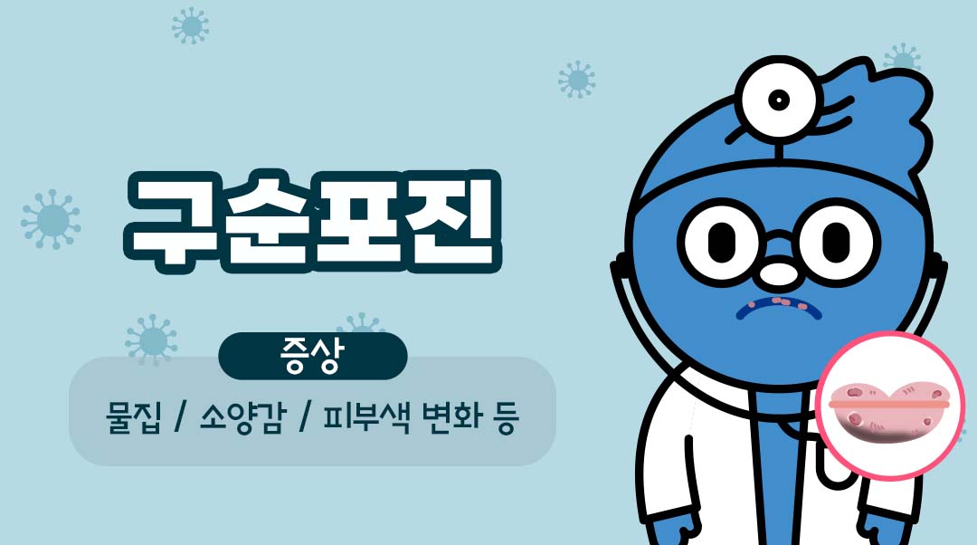 구순포진이미지