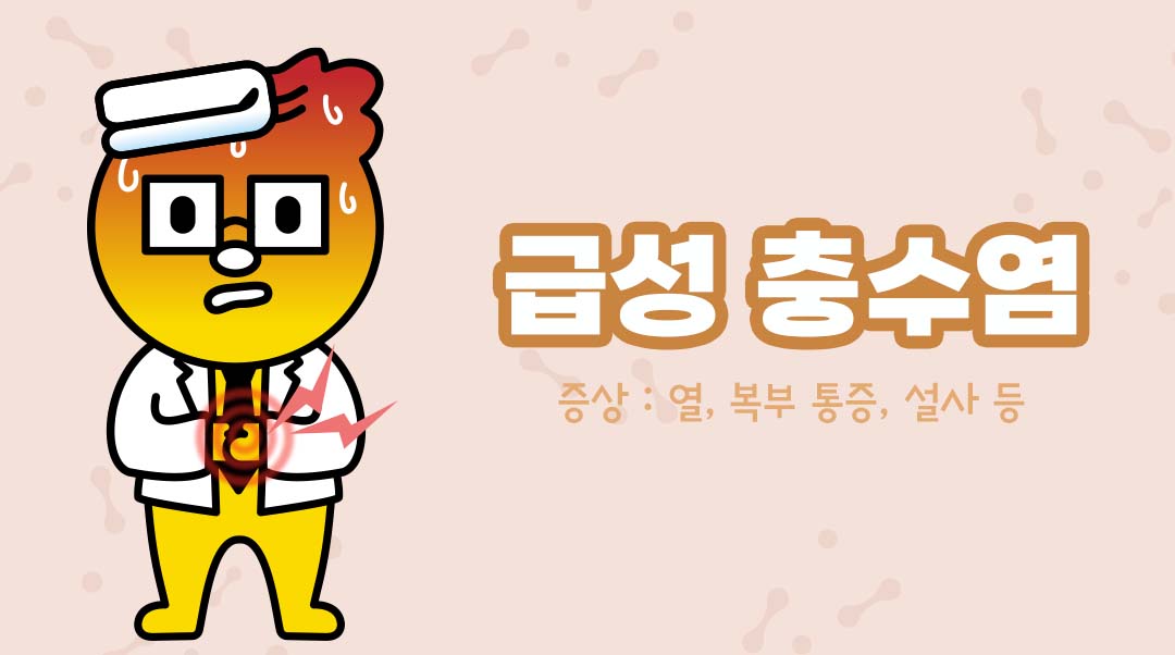 급성 충수염이미지