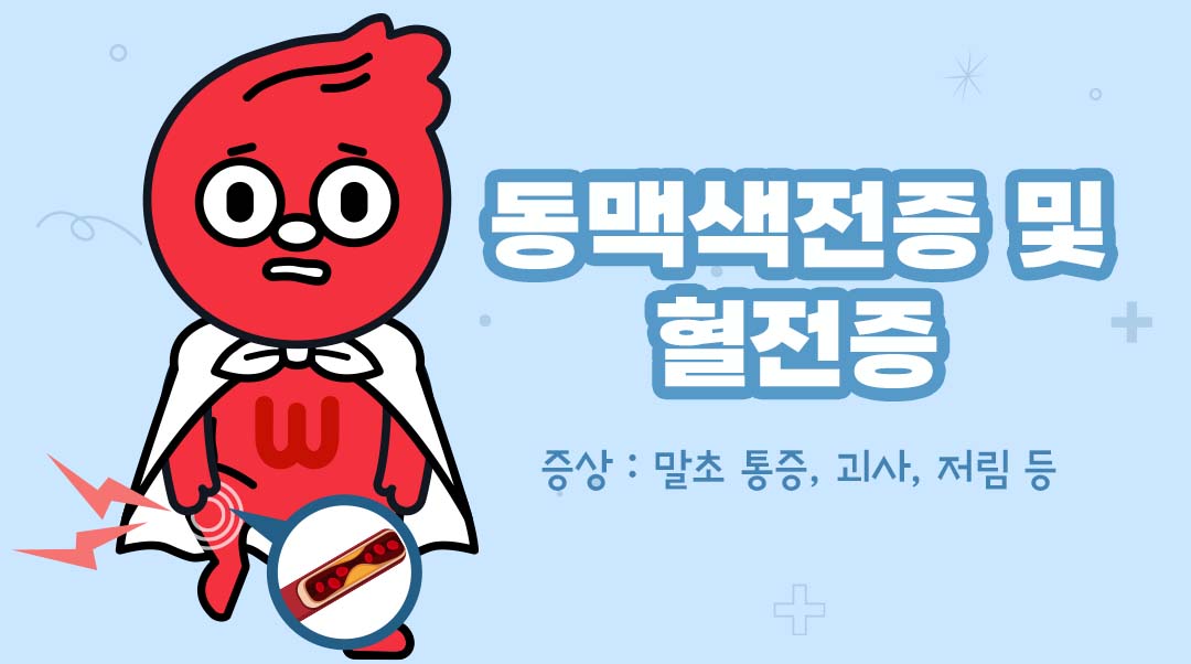 동맥색전증 및 혈전증이미지