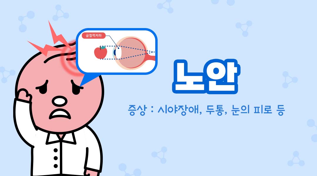 노안이미지