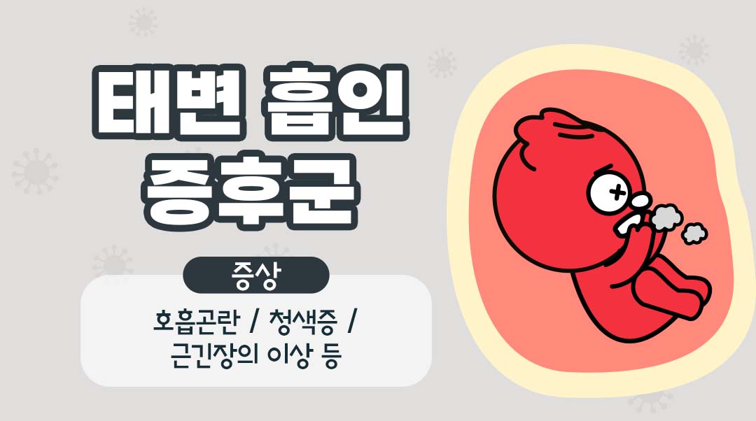 태변 흡인 증후군이미지