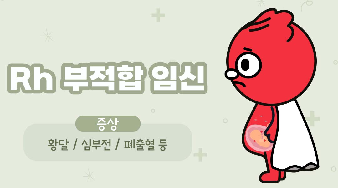 Rh 부적합 임신이미지
