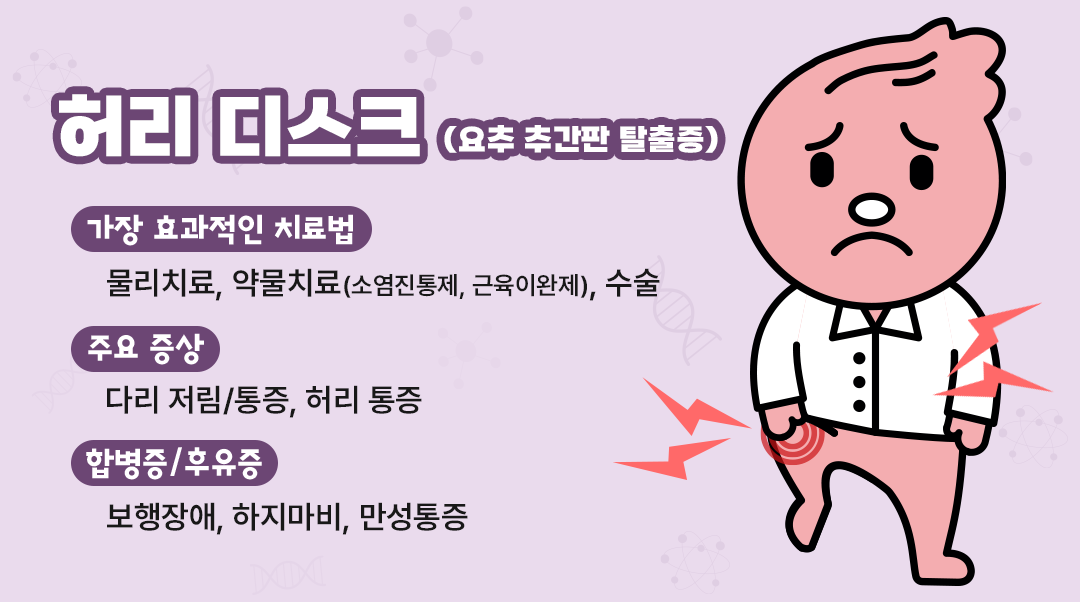 허리 디스크이미지