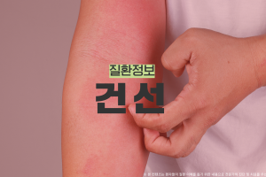 후다닥 건강교육 - 건선은 어떤 질환인가요? 썸네일 이미지