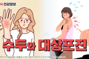 수두와 대상포진에 대해 알아보자! [후다닥 건강정보] 썸네일 이미지