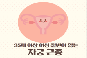 35세 이상 여성 절반이 앓는 자궁근종 썸네일 이미지