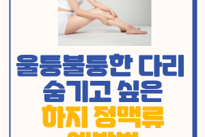 울퉁불퉁한 다리, 숨기고 싶은 하지정맥류 예방법 썸네일 이미지