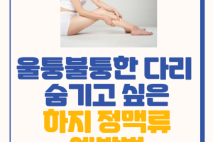 울퉁불퉁한 다리, 숨기고 싶은 하지정맥류 예방법 - 카드뉴스 브이로그 24부  썸네일 이미지