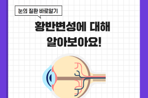 황반 변성에 대해 알아보아요! 썸네일 이미지